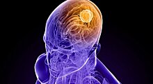 Генная терапия лечит смертельный рак мозга