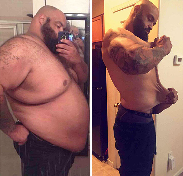 Этому мужчине врачи сказали, что он умрет, если не похудеет. Он сбросил почти 150 кг.