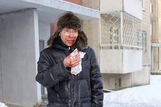 Неизвестные избили помощника депутата в Екатеринбурге