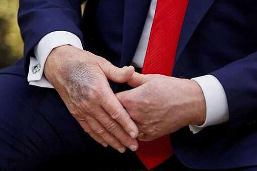 WSJ: Трамп скрывает под гримом синяки и другие физические признаки старения