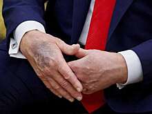 WSJ: Трамп скрывает под гримом синяки и другие физические признаки старения