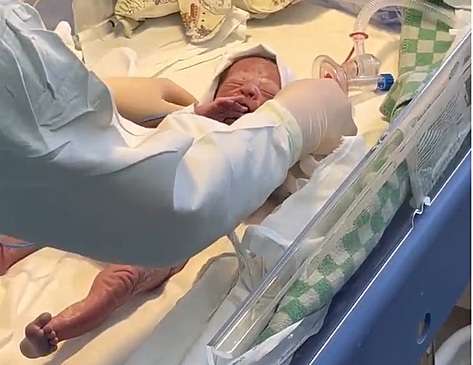 В перинатальном центре родилась первая в этом году тройня