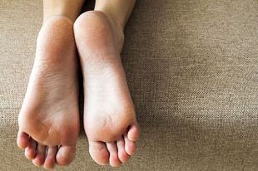Как избавиться от натоптышей на ступнях ног?