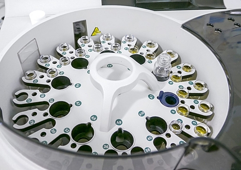 Ученые выяснили спустя 150 лет, почему моча имеет желтый цвет