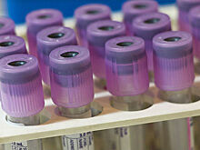 Споры вокруг нового метода: может ли анализ крови точно диагностировать аутизм?