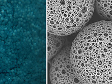 Полимеры кишечных бактерий повлияли на восстановление костной ткани