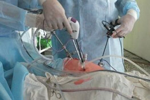 В Краснодаре онкологи провели операции по восстановлению участков гортани
