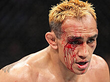 Тони Фергюсон расторг контракт с UFC