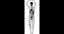 Первый в мире сканер для всего тела: посмотрите на уникальные фотографии