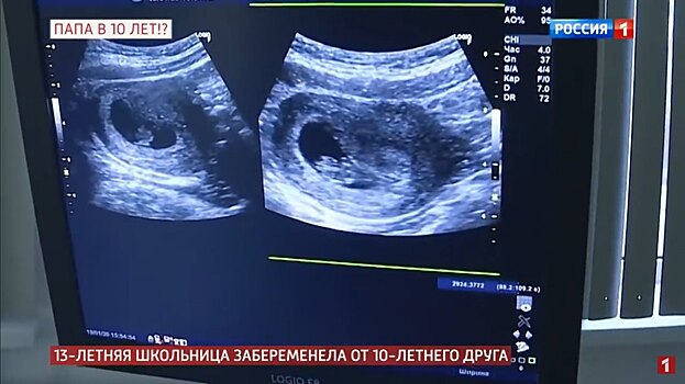 В Тюменской области с беременных брали деньги за определение пола ребенка
