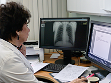 Ученые предложили новый способ обнаружения рака легкого