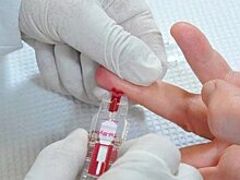 Ученые нашли способ определить группу крови за две минуты