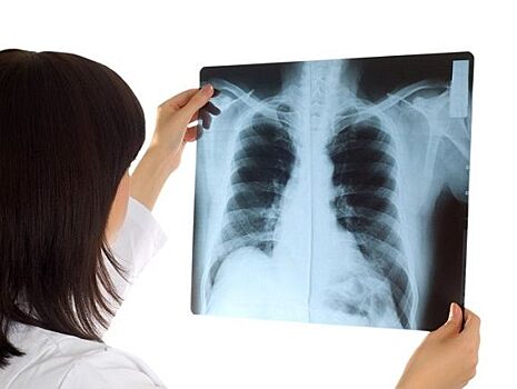 Рентген: какой его вид самый опасный для здоровья