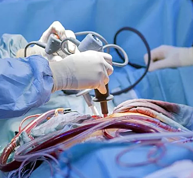 Пятигорск осваивает новые операции – аортокоронарное шунтирование