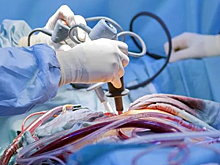 Пятигорск осваивает новые операции – аортокоронарное шунтирование