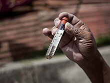 На Гаити подтвержден случай микроцефалии от лихорадки Зика