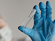 Кардиолог рассказал, почему не обязательно сдавать анализы на наследственную гипертонию