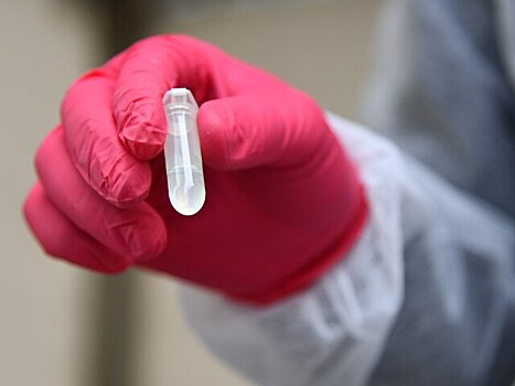 В России разработали кожный тест на клеточный иммунитет к COVID-19