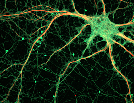 Найдено 700 генетических вариаций, связанных с депрессией