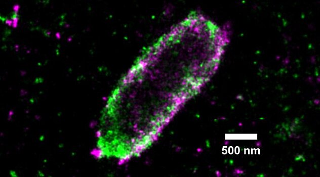 Как клетки организма расправляются с бактерией сальмонеллы?