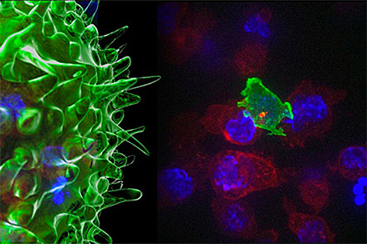 Ученые сняли на видео атаку Т-киллеров на раковые клетки