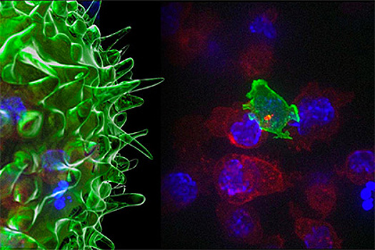 Ученые сняли на видео атаку Т-киллеров на раковые клетки