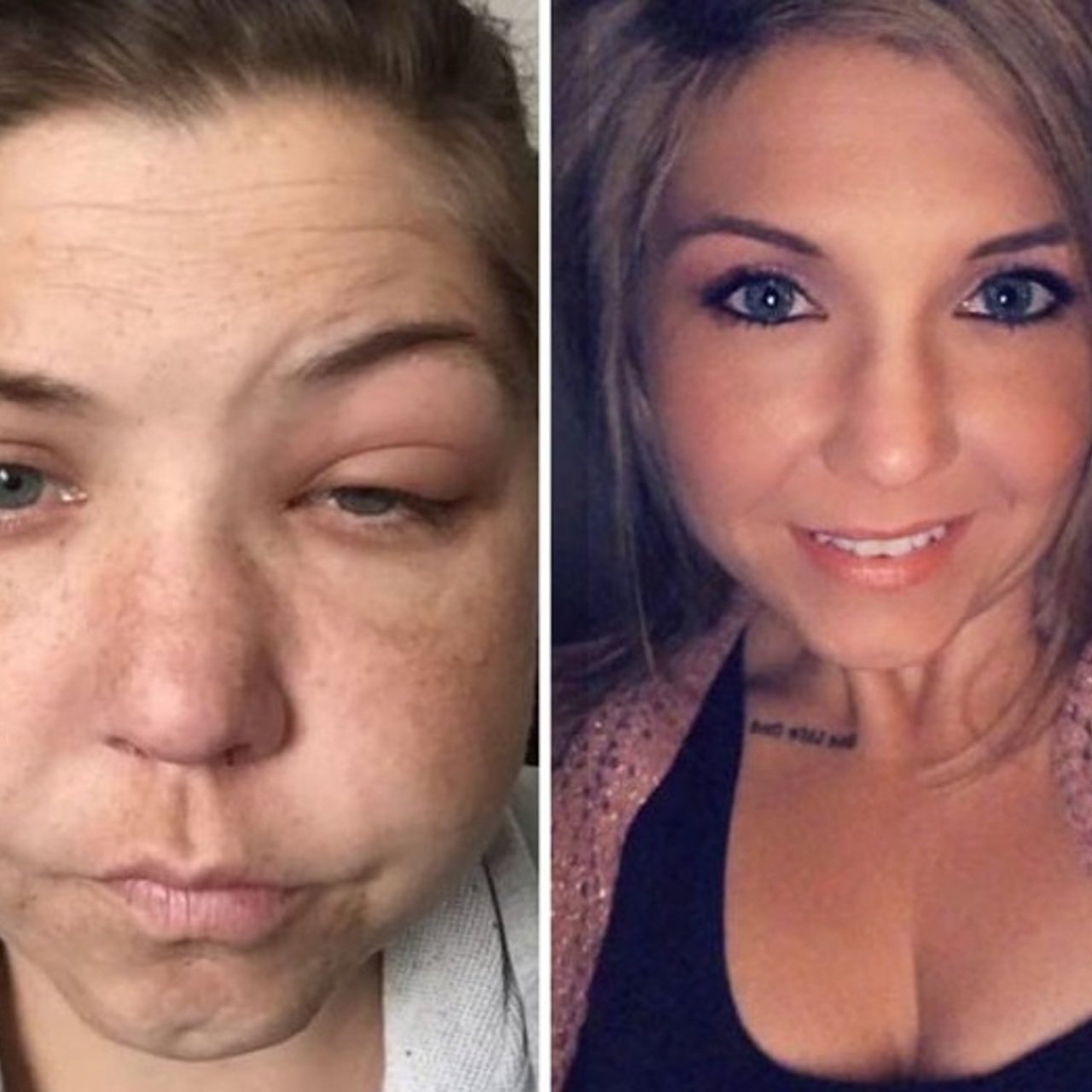 Матка при внематочной беременности. Почему учащается сердцебиение. Почему после н. Атопическийдегматит на лице. Причины учащения пульса.