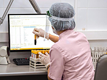 В Москве снизился уровень коллективного иммунитета к COVID-19