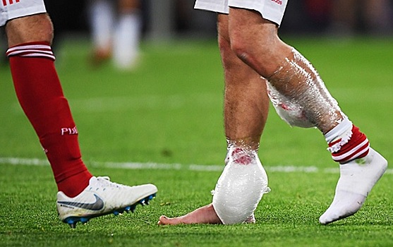 Карпин продолжает нести потери. Просто напасть какая-то перед важнейшими отборочными играми. А на кону – не только первое место в группе