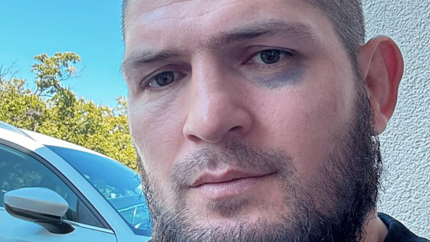 Ислам Махачев поставил Хабибу синяк под глазом