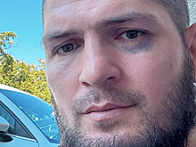Ислам Махачев поставил Хабибу синяк под глазом