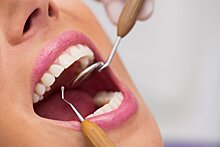 Как справиться с повышенной чувствительностью зубов