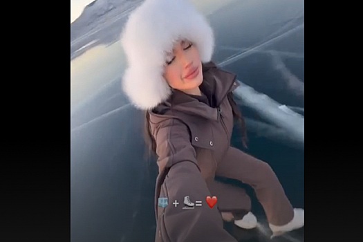 Алина загитова после пластики фото