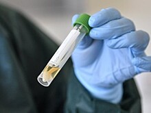 Тесты на антитела поступят в Калужскую область в ближайшие дни
