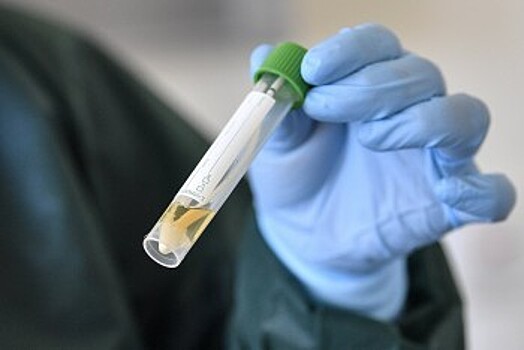 Тесты на антитела поступят в Калужскую область в ближайшие дни