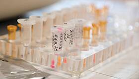 Чего нельзя делать перед сдачей анализов крови