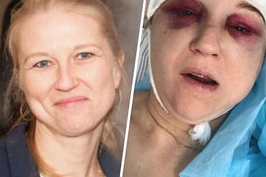 В Екатеринбурге жестоко избили женщину, которая подкармливала бездомных собак