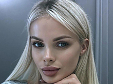 Модель Анжелику Тартанову, избитую любовником до комы, не узнали даже подруги: вся в синяках, половины черепа нет