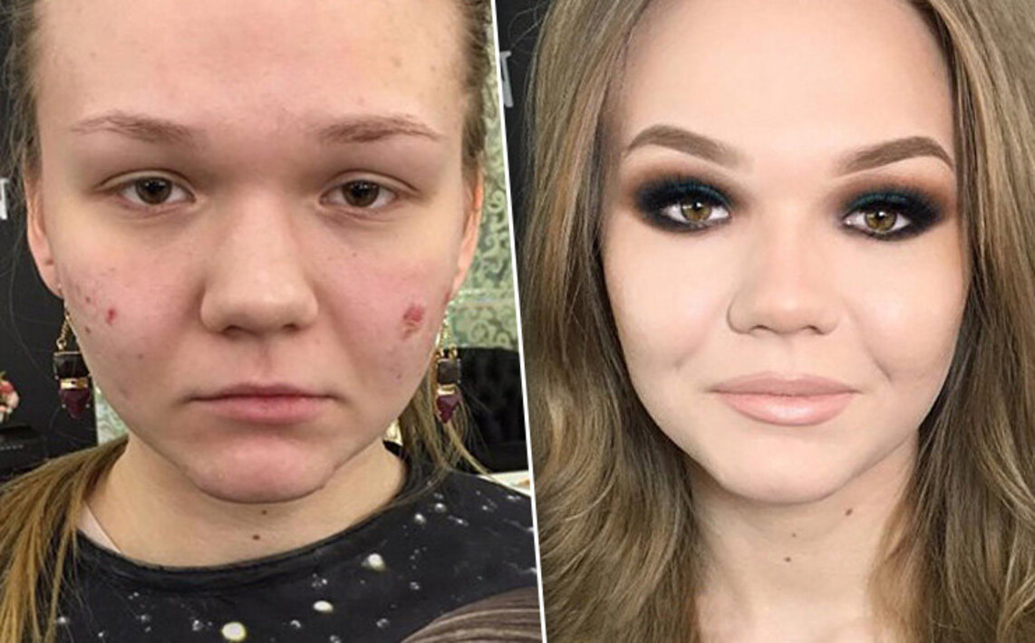 Ставшие после 25. Макияж на проблемной коже до и после. Вечерний макияж на проблемной коже. Девушка с проблемной кожей.