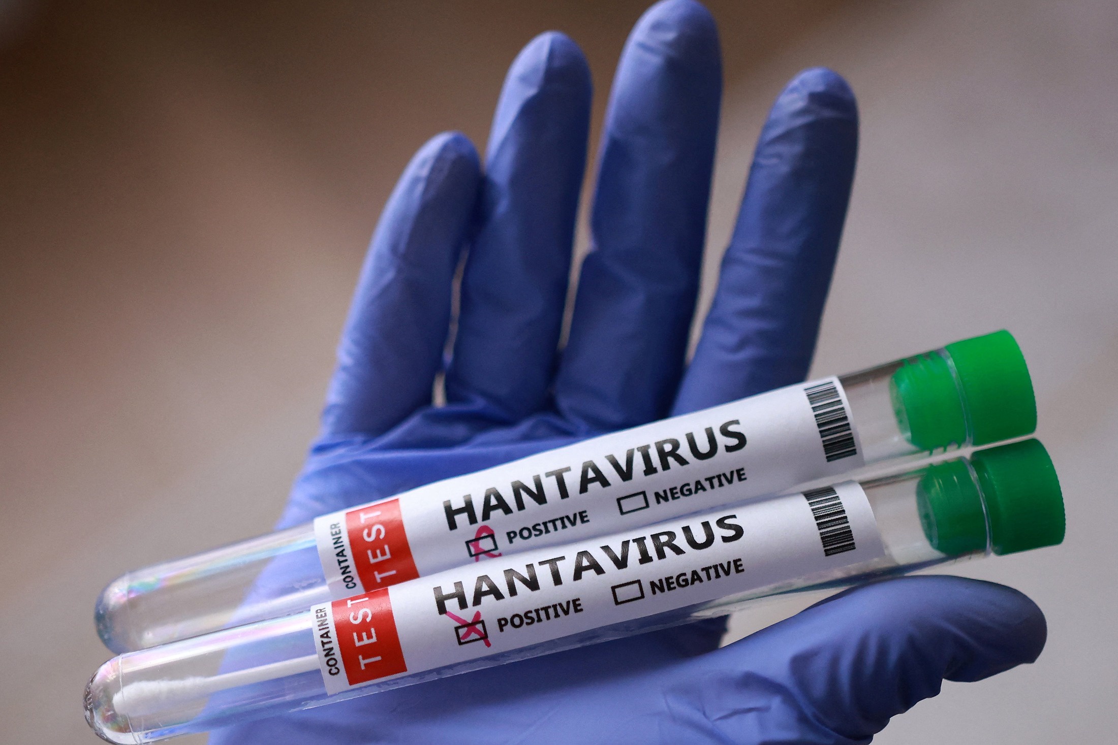 Зафиксированы новые случаи хантавируса в Испании и на островах в Атлантике