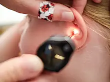 Как проводят сложные операции по восстановлению слуха в Армении