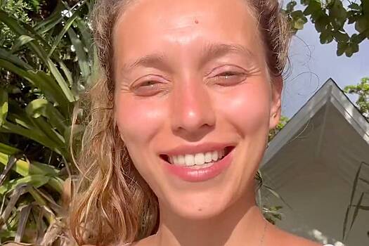 Регина Тодоренко показала обгоревшее на солнце лицо без макияжа