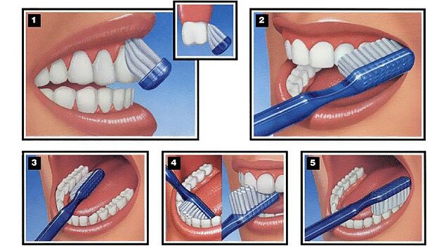 Как правильно и эффективно чистить зубы