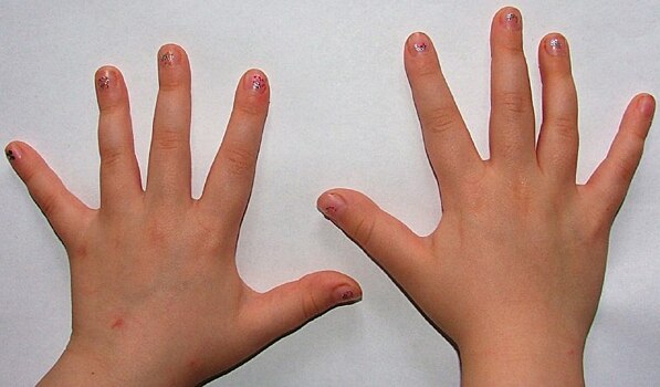 Дошкольники Отрадного приняли участие в проекте «Чудеса на кончиках пальцев»