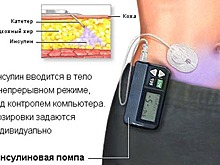 Псковичка рассказала Турчаку, как комитет по здравоохранению игнорирует детей-инвалидов