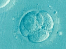 Не уступает Кунсткамере: в Челябинске оцифруют музей эмбрионов