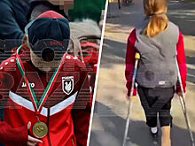 «Рубин» займется восстановлением 11-летней футболистки, сломавшей ногу воротами