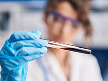 Найдена слабость агрессивного рака крови