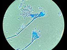 Выяснена роль нанобактерий в круговороте органики в пресных водоемах