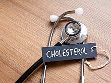 Врачи рассказали, как можно определить свой уровень холестерина